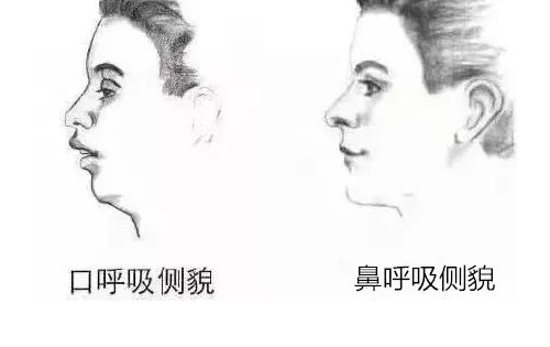 一到冬季鼻炎就严重怎么办,为什么过敏性鼻炎在夏季容易发作