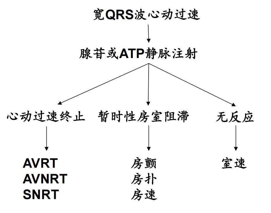 心电图上表现为宽qrs波,心电图中qrs是代表心动过速吗
