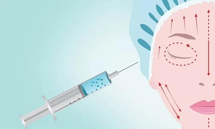 九院韦敏改脸型,九院填充太阳穴失败案例
