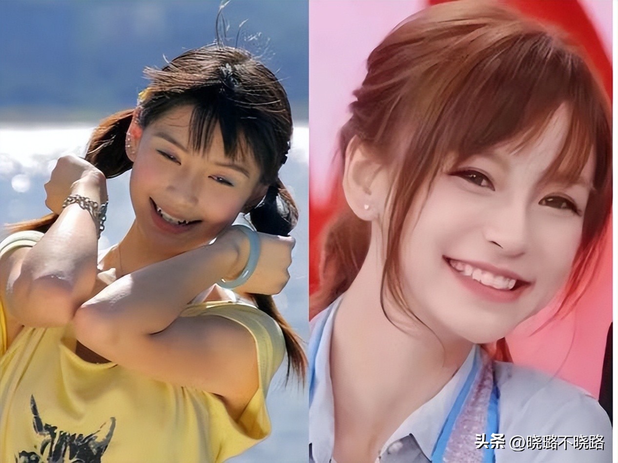 自然方法改善龅牙凸嘴,龅牙凸嘴怎么形成的