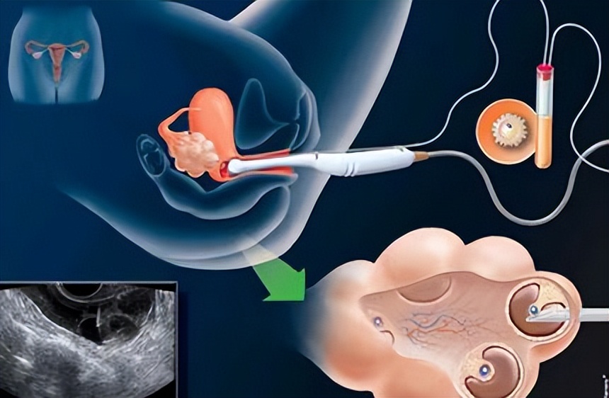 三次试管婴儿移植都失败了怎么办,三次试管失败怎么办钱也花完了