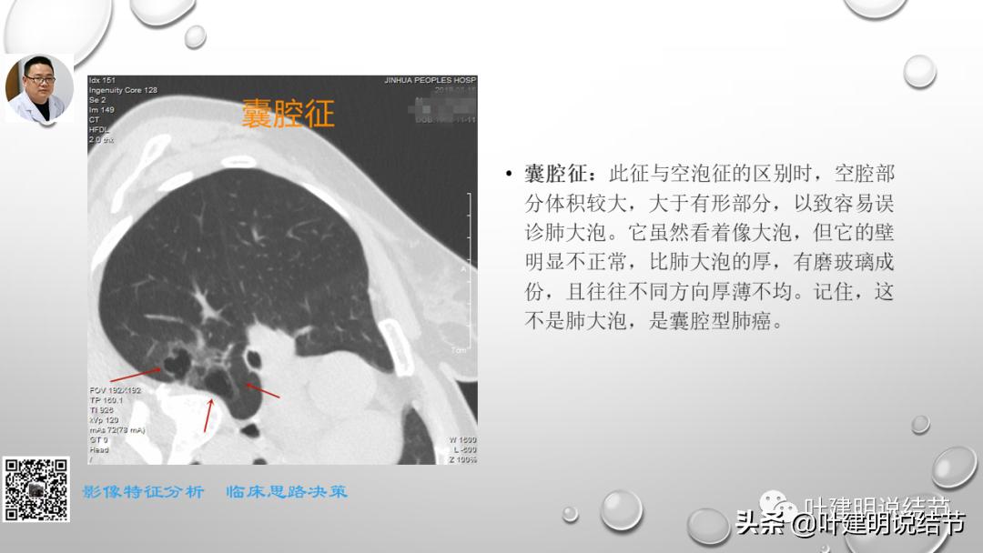 在《一脉阳光》呼吸影像诊断专题培训班上的讲课PPT（第一部分）