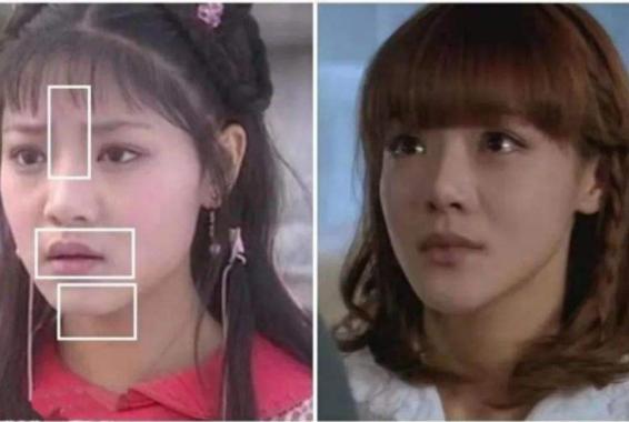 内娱谁的鼻子整过,内娱谁的鼻子最好看