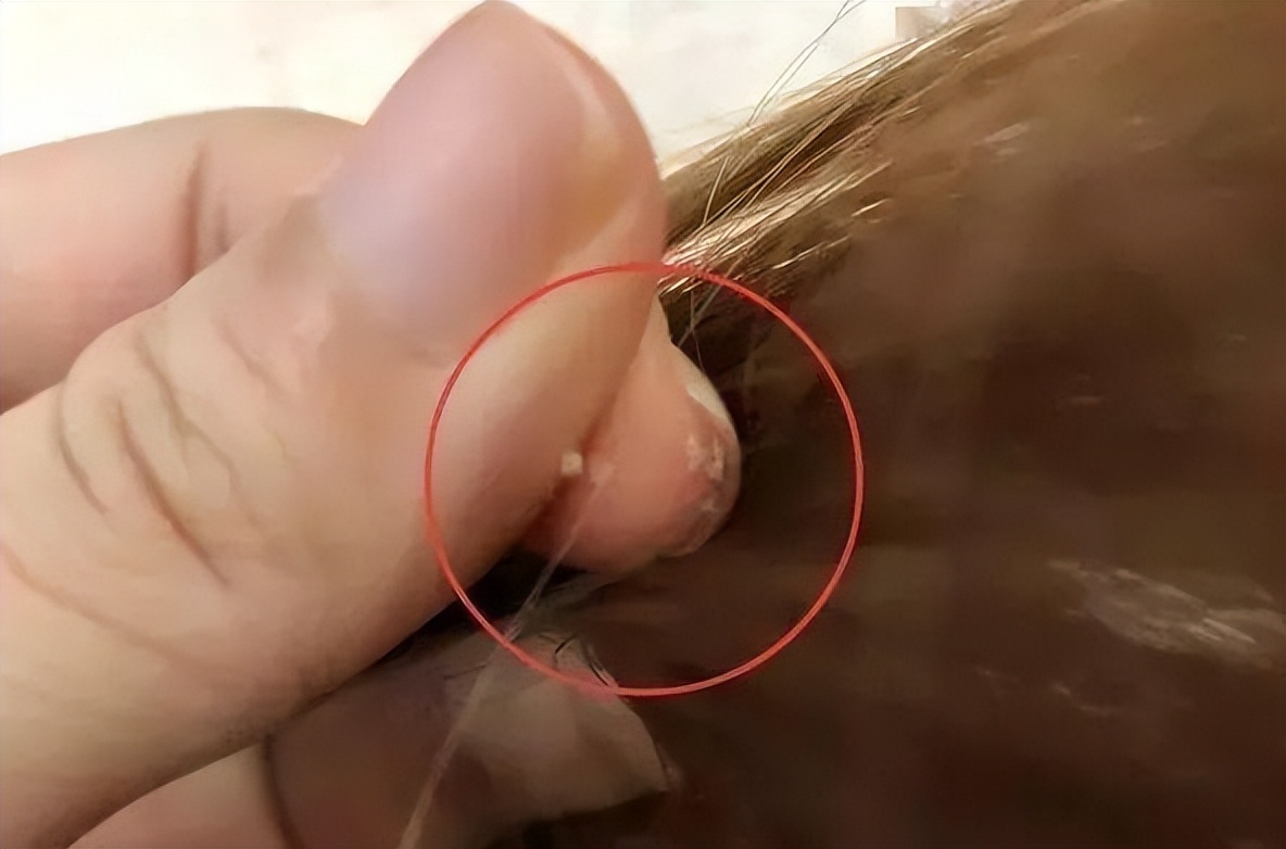 一抓头皮指甲里就有白泥怎么办,头皮一抓指甲里都是白泥