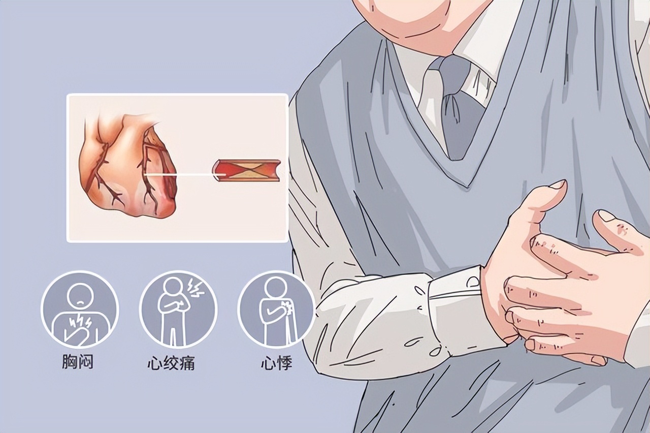 胸闷气短心绞痛中医调理,中医治疗冠心病用药