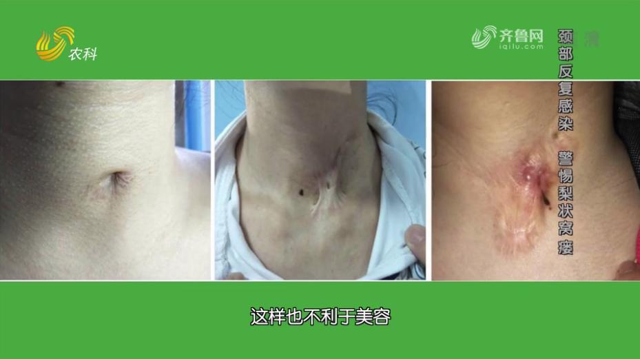 耳鼻喉科田家军,咽喉科田家军