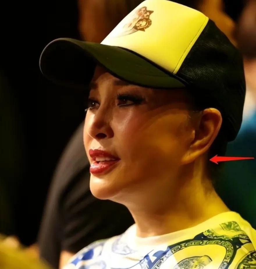 整容失败的明星张檬后悔吗,整容变毁容的女星张檬