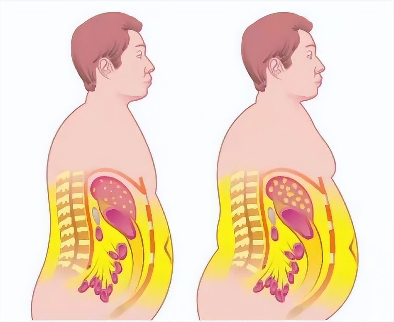 8年前，江西14岁体重300斤少年求救，希望医生让我活下去