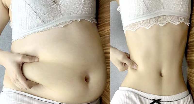 为什么抠肚脐眼肚子痛怎么缓解,抠肚脐眼肠子疼