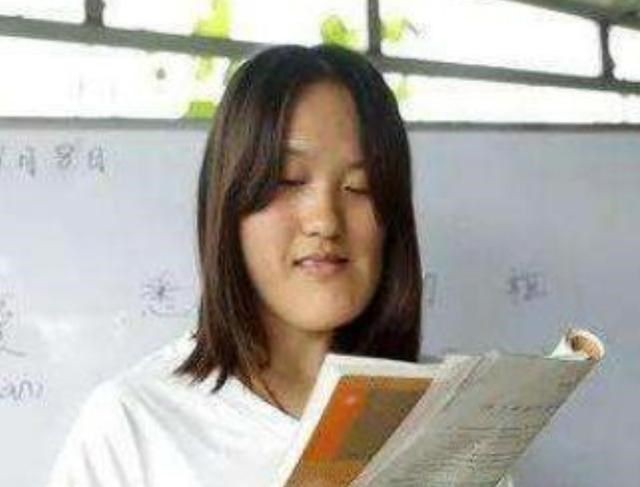 女孩因高烧毁容，后获郭明义帮助整形成功，高颜值引网红公司争抢