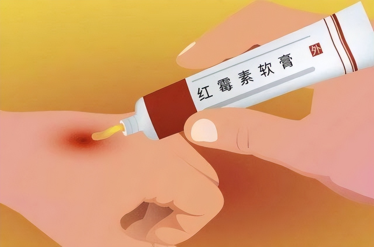 红霉素软膏在眼部涂两下，身体会怎样？不妨了解