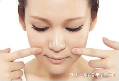 益阳专业祛除法令纹,霸州祛法令纹