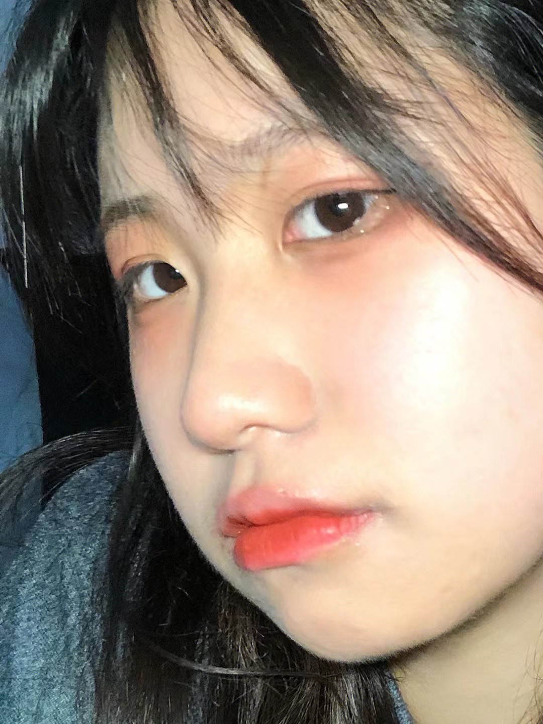 下巴总长痘痘粉刺怎么回事,姨妈之前下巴长痘痘怎么解决