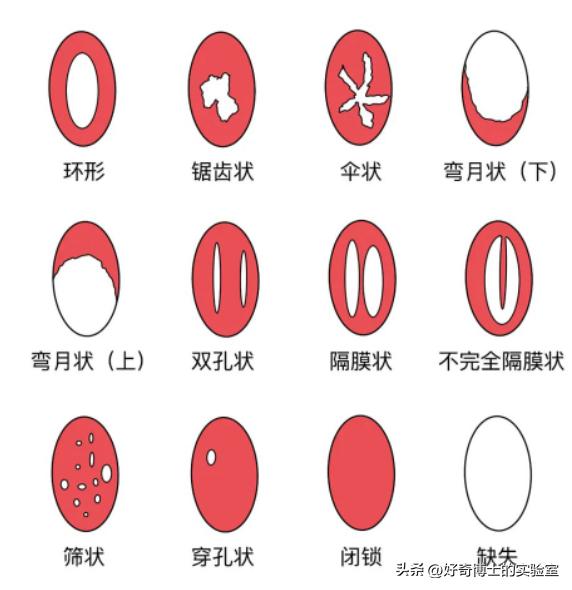 女生阴道还有长短？多长才算正常？太长太短对*生活性**有哪些影响？