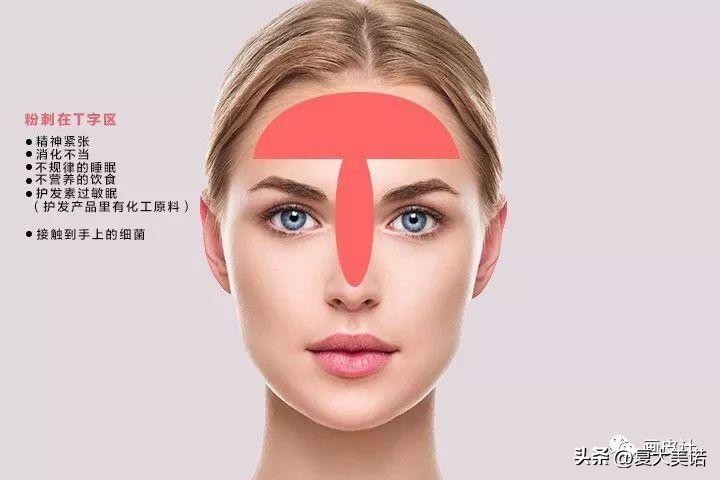 复大美诺祛斑,复大美诺多肽净颜液