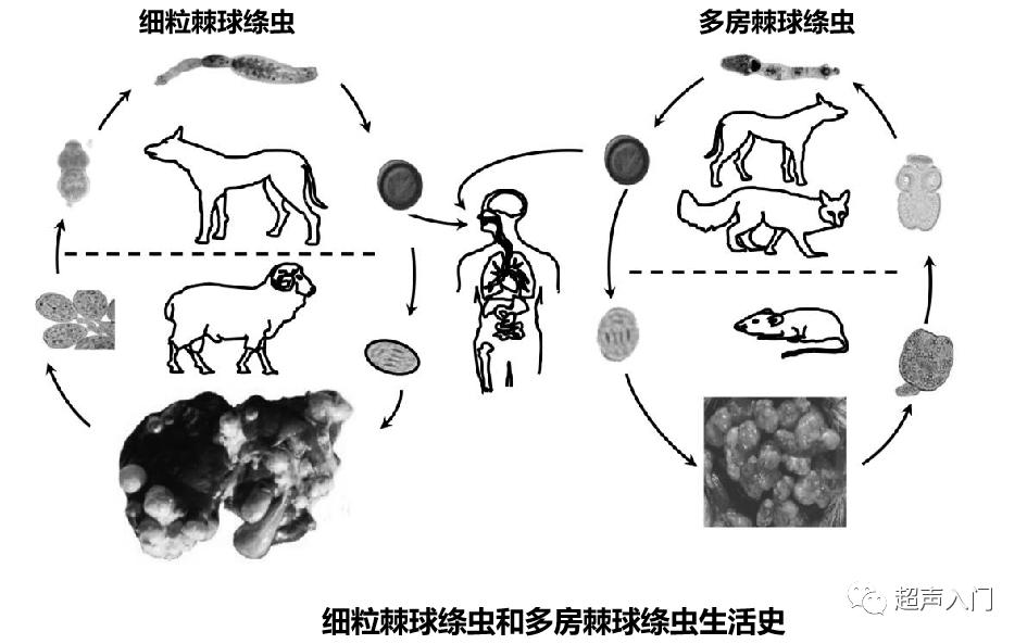 肝包虫病B超能检查出来吗?