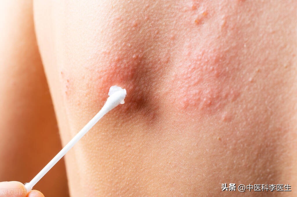 挂的专家号却是新手看病怎么办,第一次看病挂普通号还是专家号好