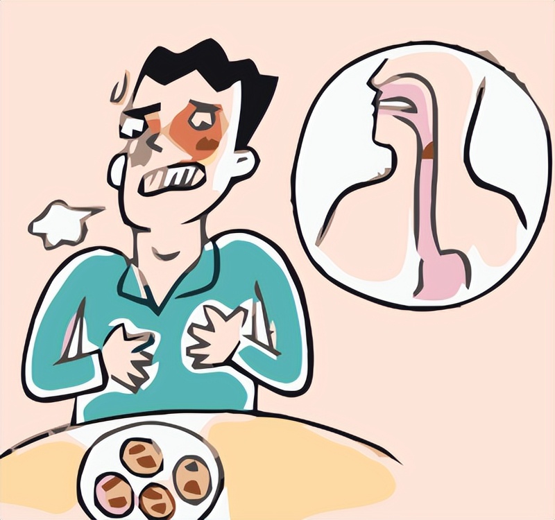 食管异物医疗科普知识小常识,怎么能判断是食管异物