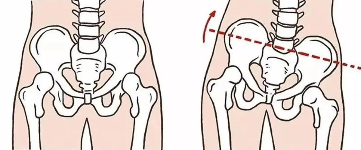 背部会出现哪些问题,背部能看出身体不好吗