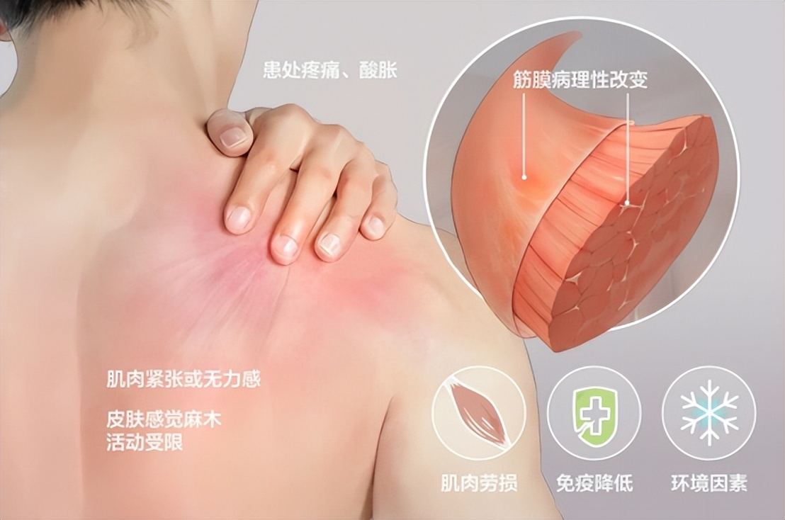 筋膜枪的作用和使用方法,筋膜枪的副作用和危害