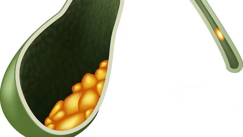 为什么会肠道长息肉,肠道容易长息肉是什么原因