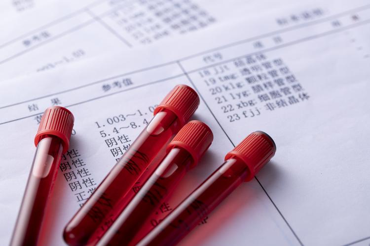 平时正常的血糖值应该为多少,正常人血糖值控制在多少比较合适