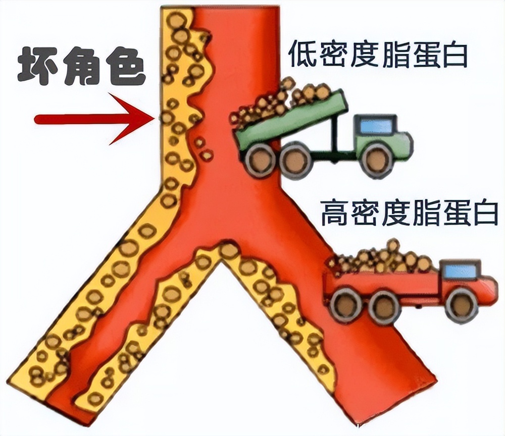 体检高脂血症需要治疗吗,高血脂的指标超出多少需治疗