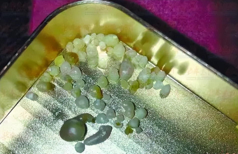 文胸、高尔夫、炮弹、珍珠、*物文**，盘点这些从动物肚里发现的东西