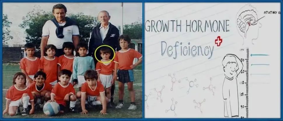 从侏儒到世界球王催泪纪录片,从小患上侏儒症梅西