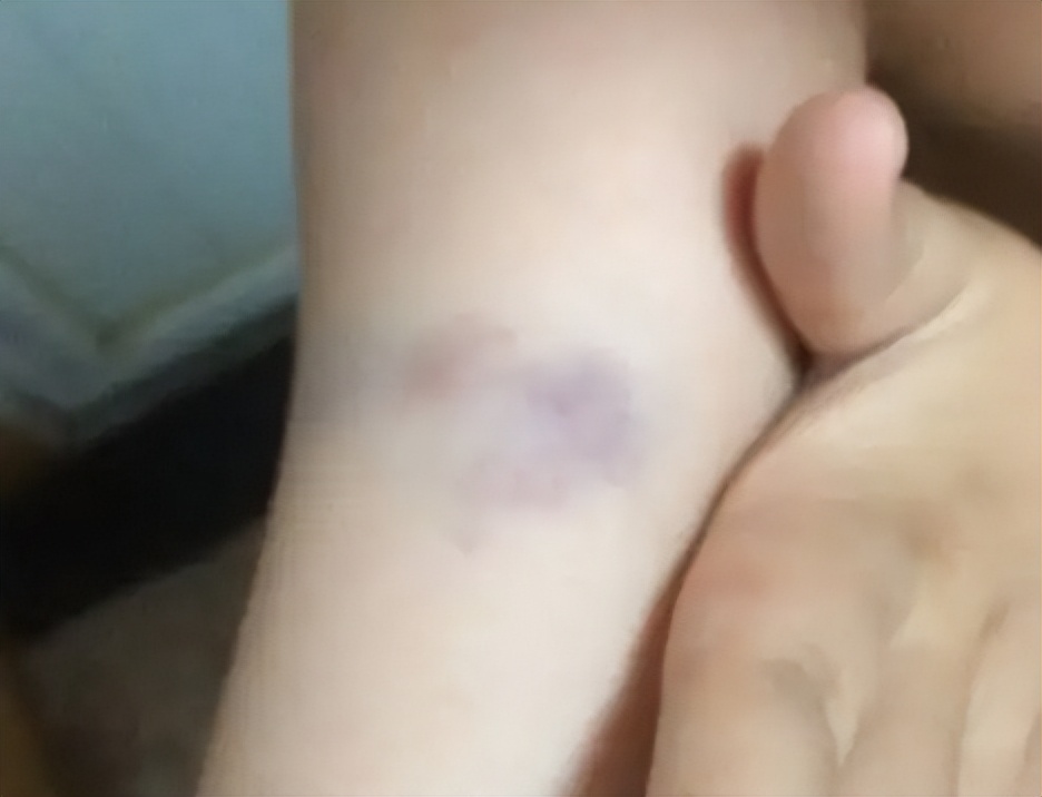 筋膜枪如何选择,筋膜枪挑选指标