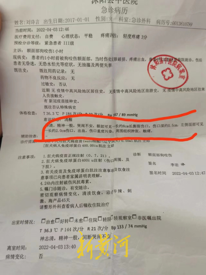 江苏一5岁女童被大狗咬伤致毁容，狗主人系公职人员