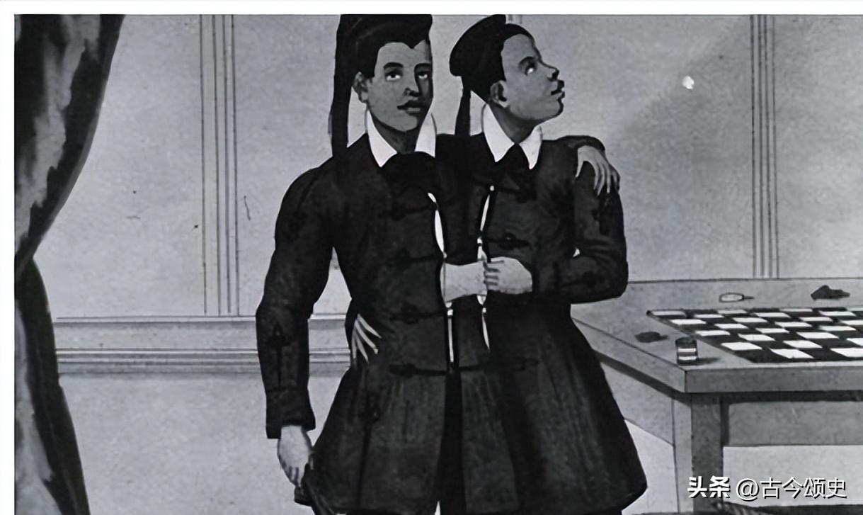 连体人结婚生子,连体人如何生子