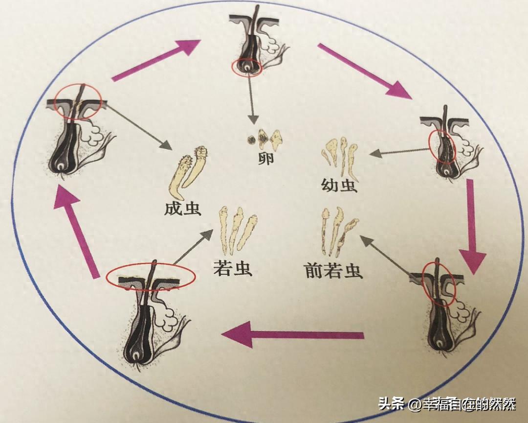 羽绒被太阳晒能杀菌吗,羽绒被洗后晒干有黄渍