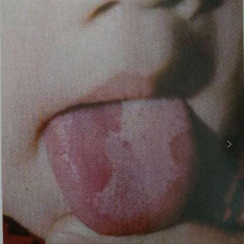 中医四诊中的正常舌象,中医看舌象准还是摸脉准