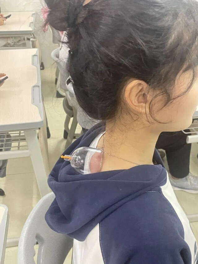 头发上拔罐技巧,帅气老师扎头发