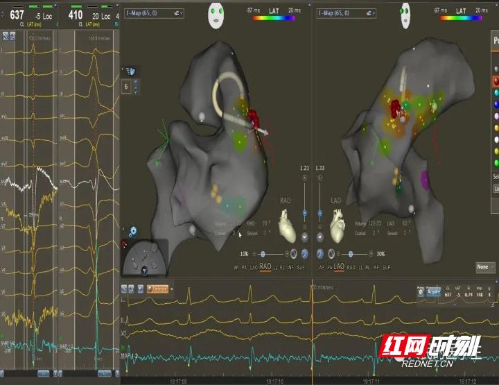 张家界医院可以做手术吗,张家界人民医院可以做激光手术吗