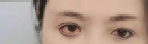 315曝光名单里没有医美吗,315曝光美容整形