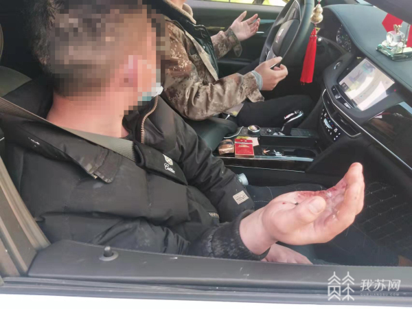 防水胶炸伤右手面临截肢交警争分夺秒为其争取时间