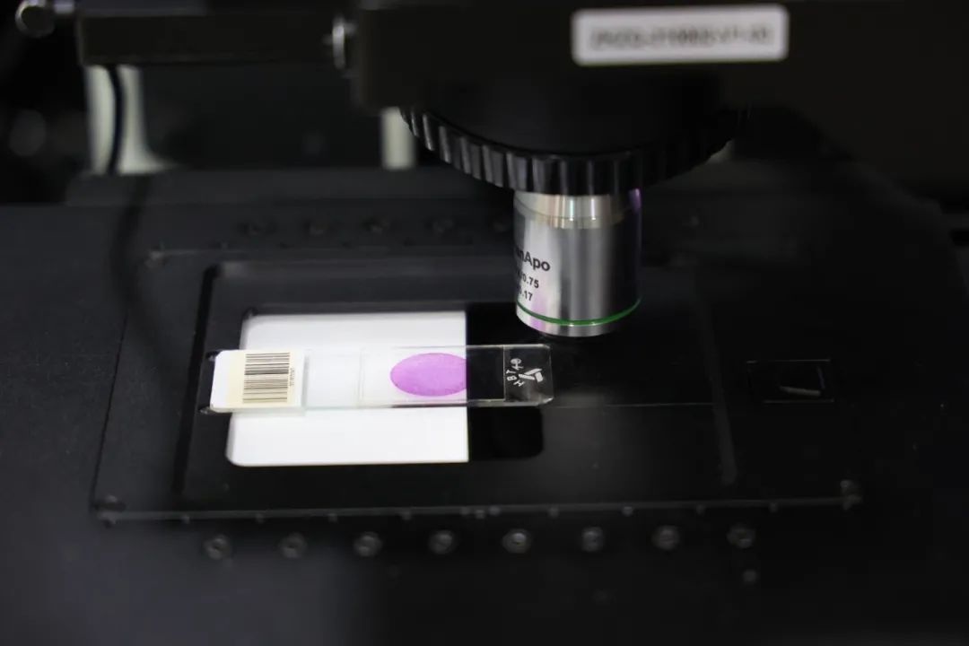 华科博士后光谷创业，研发手机显微镜，贴在手机上能看到细胞核