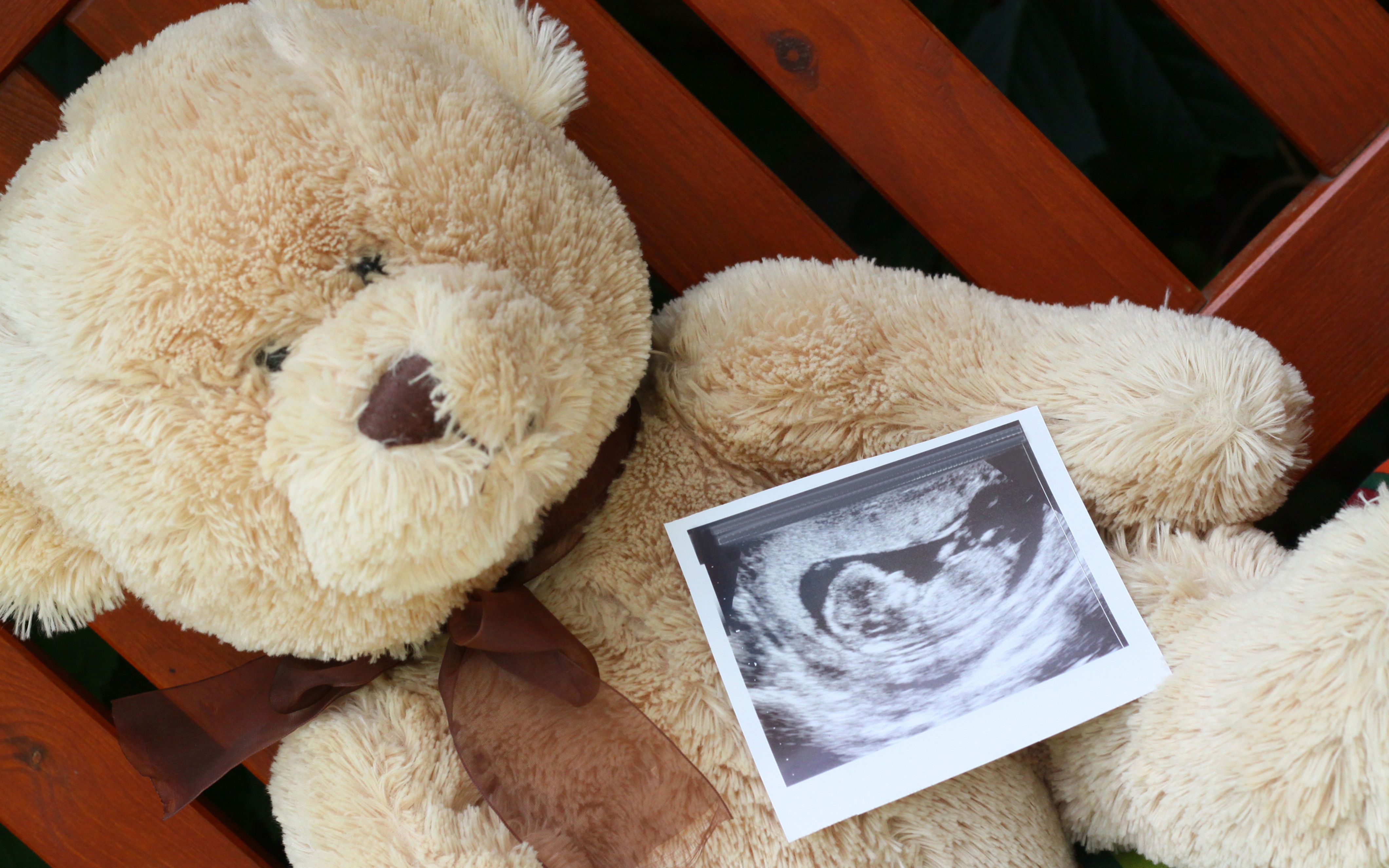 胎儿怎么才会脐带绕颈,胎儿脐带缠绕医生怎么处理