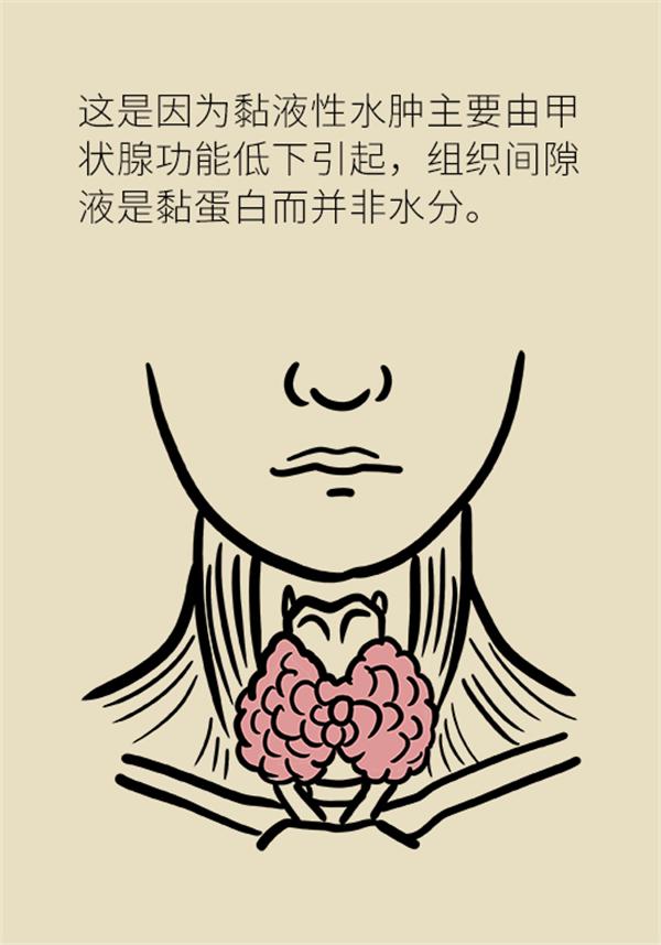 身体出现水肿需要做哪些检查,身体出现水肿吃什么药好