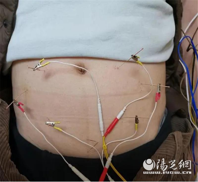 西安市第三人民医院康复科怎么样,西安市第三医院康复科主任