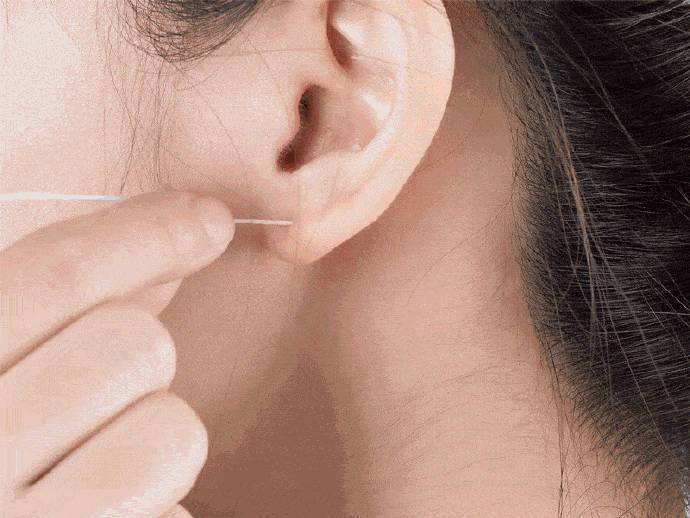 打耳洞感染事件,打耳洞造成颅内感染