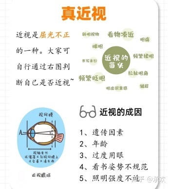 蔡司成长乐有效减缓青少年近视,蔡司小乐圆近视防控眼镜片图片