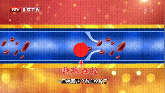 春季如何吃鱼养生,春天就该多吃它养生又好吃